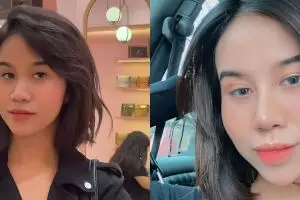 Potret 9 seleb sebelum dan sesudah operasi plastik, perubahan wajah Denada curi perhatian