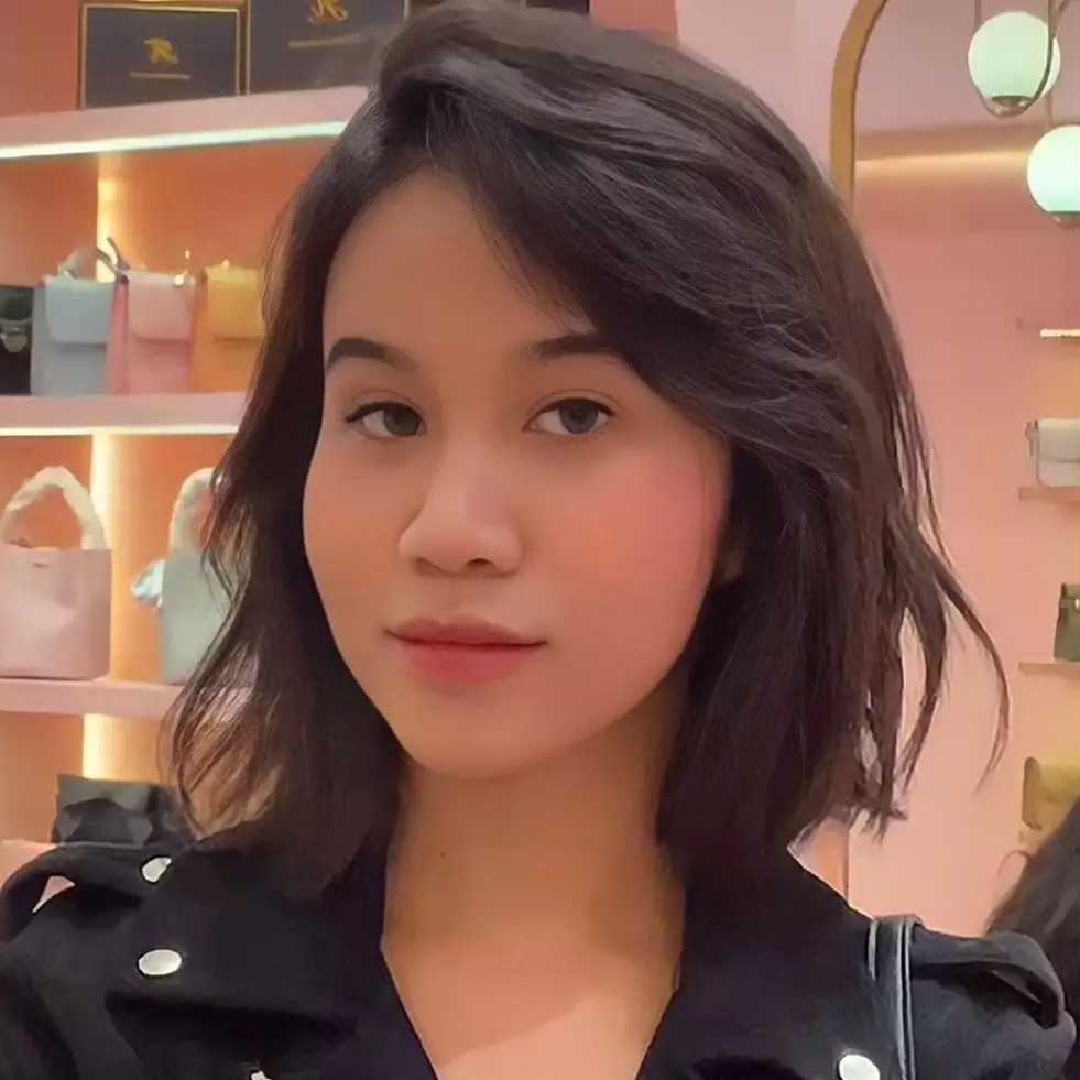 Potret 9 seleb sebelum dan sesudah operasi plastik, perubahan wajah Denada curi perhatian