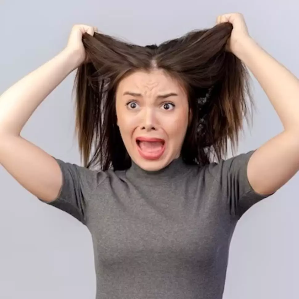 Nggak perlu beli hair powder, ini trik atasi kulit kepala berminyak cuma pakai 2 bahan makanan