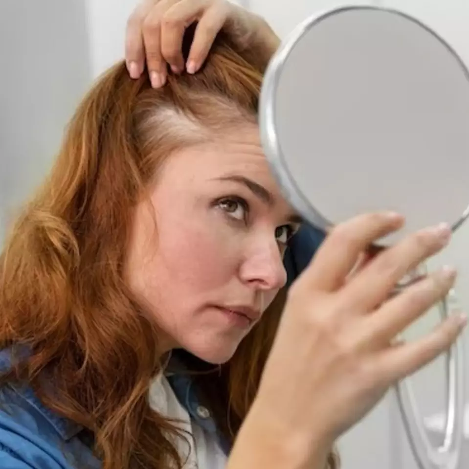 Rambut tumbuh lebih lebat, ini trik atasi kebotakan pakai tonic dari 3 bahan alami