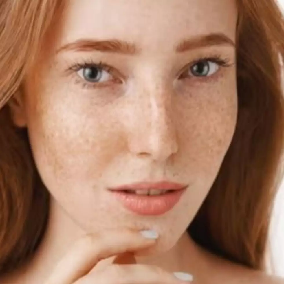 Tak perlu laser mahal, ini cara memudarkan flek hitam akibat hiperpigmentasi pakai 1 jenis daun herbal