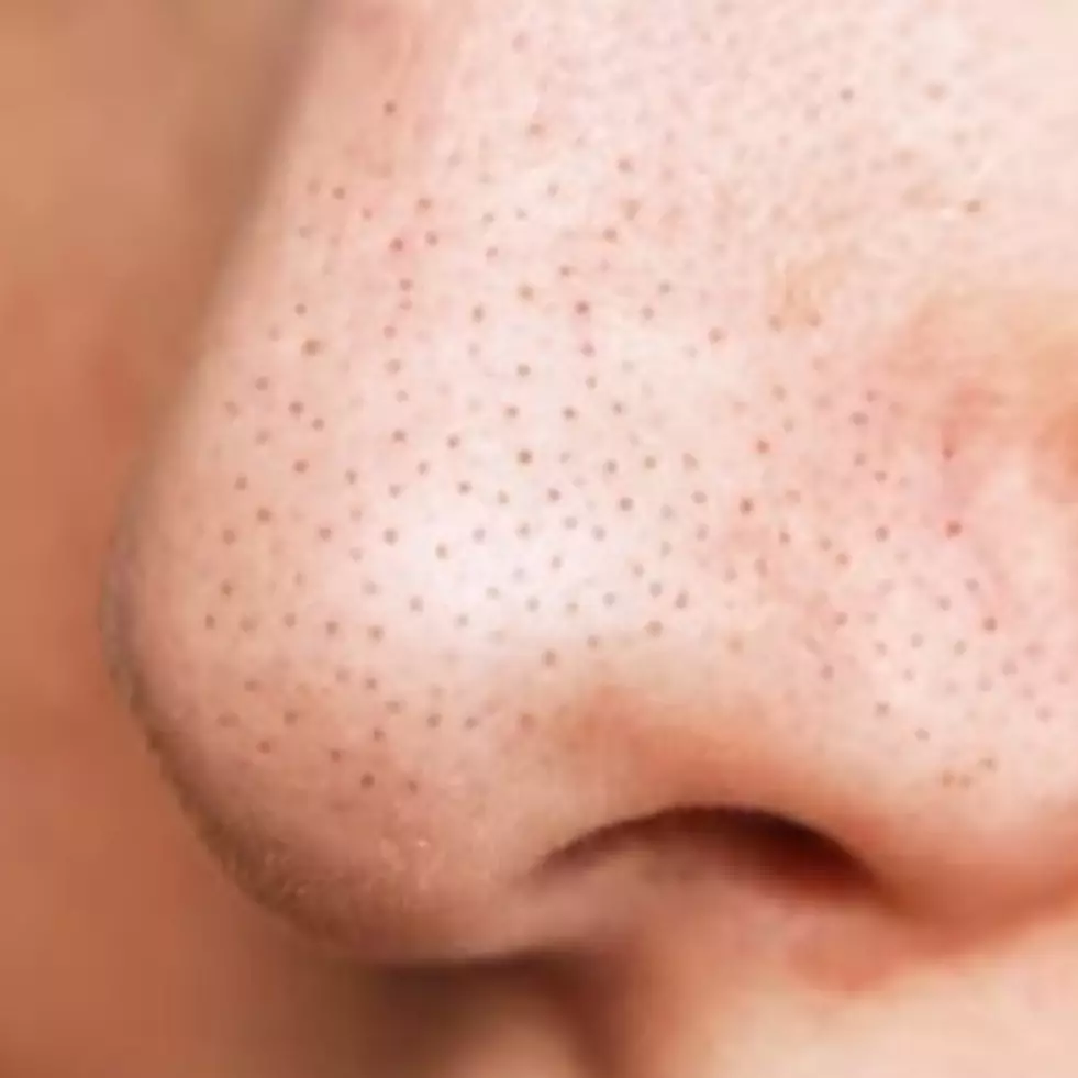 Wajah lebih mulus, begini trik hilangkan komedo hitam di hidung pakai scrub dari 2 bahan pemanis