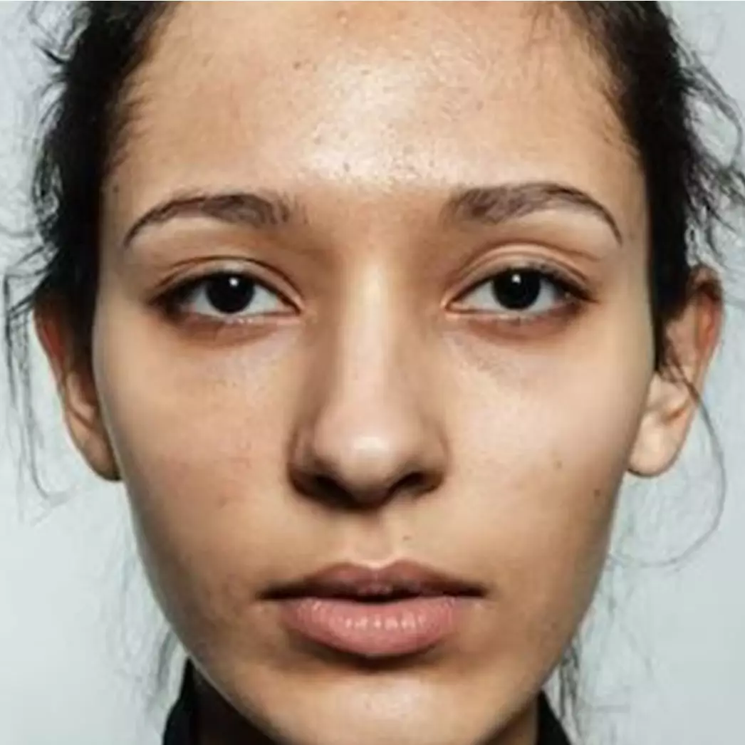 Hilang dalam seminggu, begini trik hilangkan flek dan bintik hitam di wajah hanya pakai 1 jenis kacang