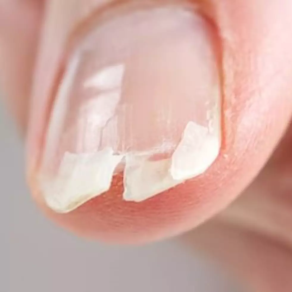 Nggak mudah patah dan cepat panjang, begini cara membuat serum penguat kuku pakai 2 bahan alami