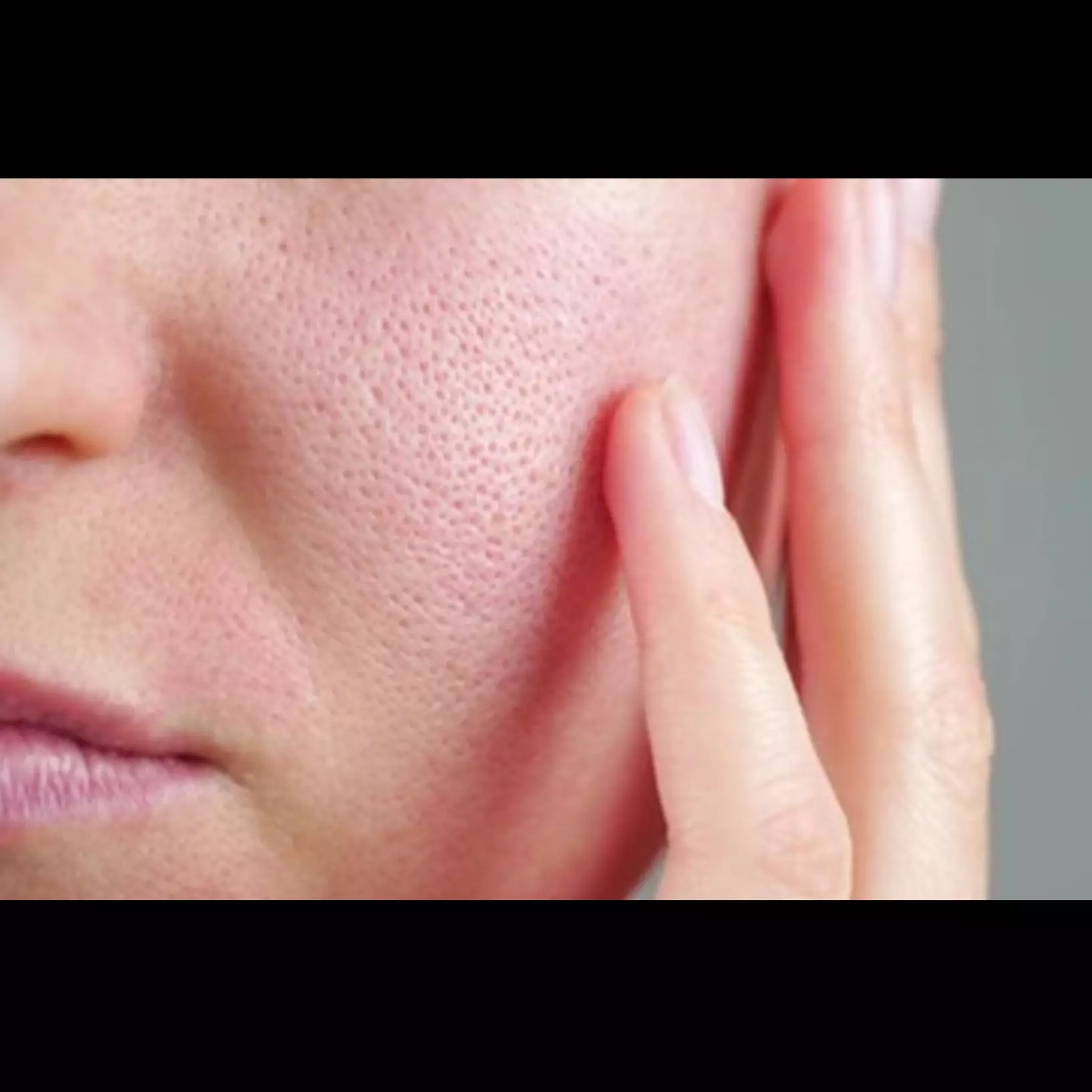 Autotampak bersih dan sehat, ini cara simpel angkat komedo di pori-pori wajah pakai 2 jenis minuman