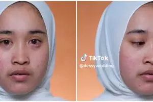 Bintit besar di bawah mata, potret wanita dimakeup jadi pengantin Sunda ini bikin klien full senyum