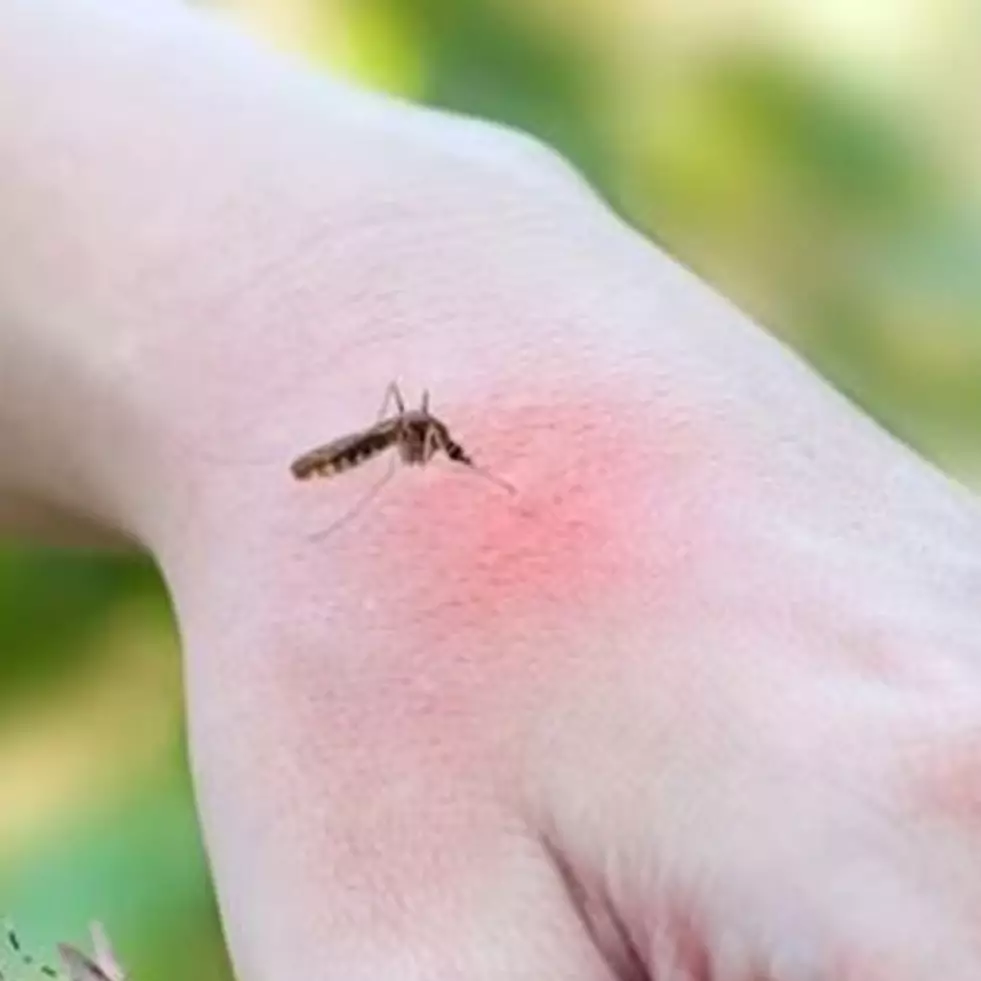 Tak perlu pakai mentimun, ini trik pudarkan noda hitam akibat gigitan nyamuk hanya pakai 1 bahan dapur