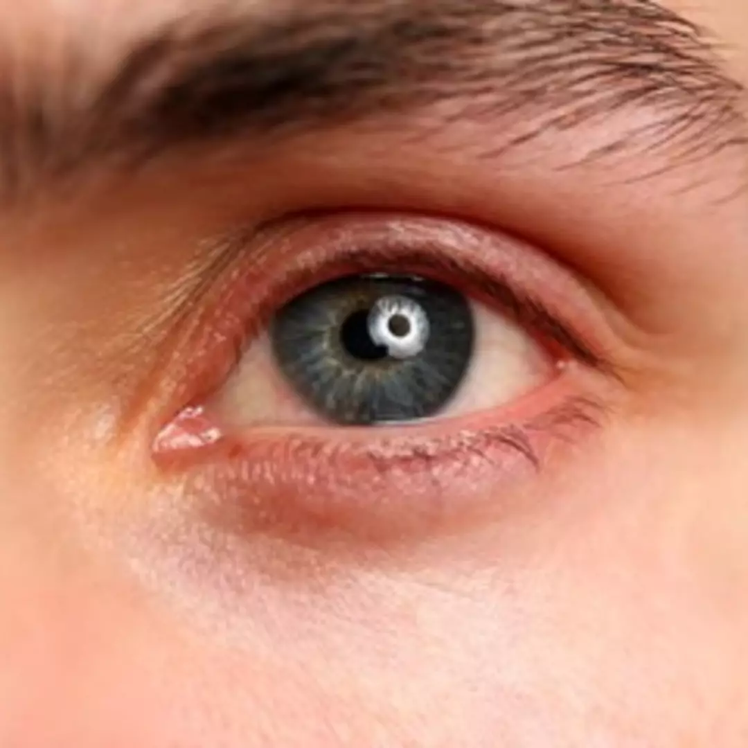 Nggak perlu beli eyelash serum, ini cara sederhana lebatkan bulu mata dan alis dengan 1 jenis minyak