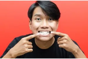 Nggak perlu scaling, begini trik pudarkan karang gigi hanya pakai 1 bahan dapur