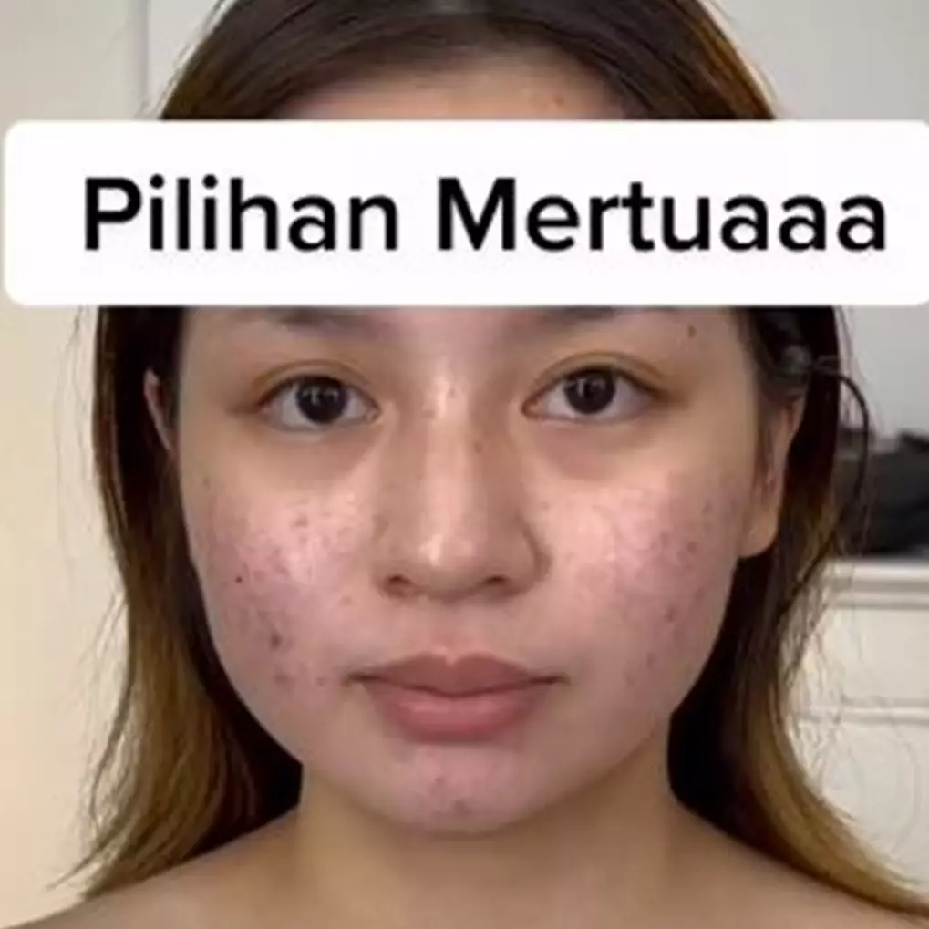 Makeup dipilihin mertua, hasil riasan wanita berjerawat ini bening abis bak model profesional