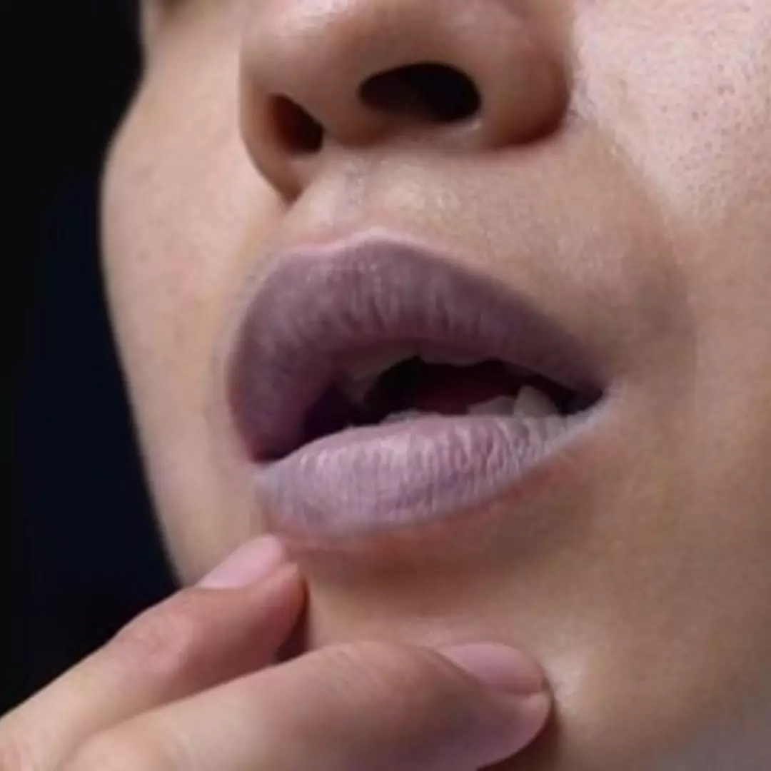Kembali merona alami, begini trik simpel pudarkan bibir gelap pakai 1 jenis minuman