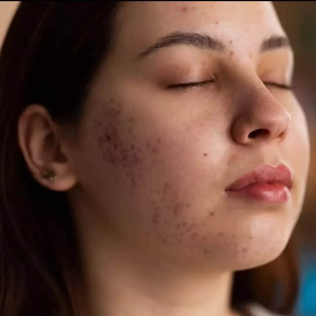 Jangan dibuang, ini trik bikin serum dari 1 jenis kulit buah untuk hempas spot hitam dan kusam