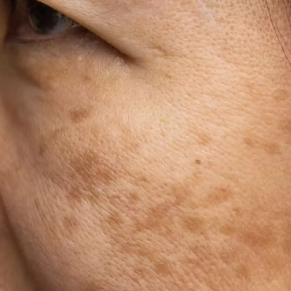 Kulit auto tampak awet muda, begini trik atasi spot hitam dan keriput cuma pakai 1 jenis kulit buah