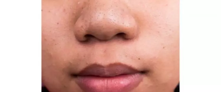 Trik hempas komedo pakai 1 topping minuman, bikin kulit gradakan jadi auto mulus