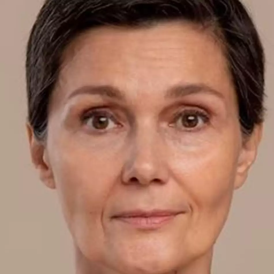 Tak perlu botoks, ini cara hilangkan kerutan di dahi akibat gerakan berulang hanya pakai 1 jenis buah