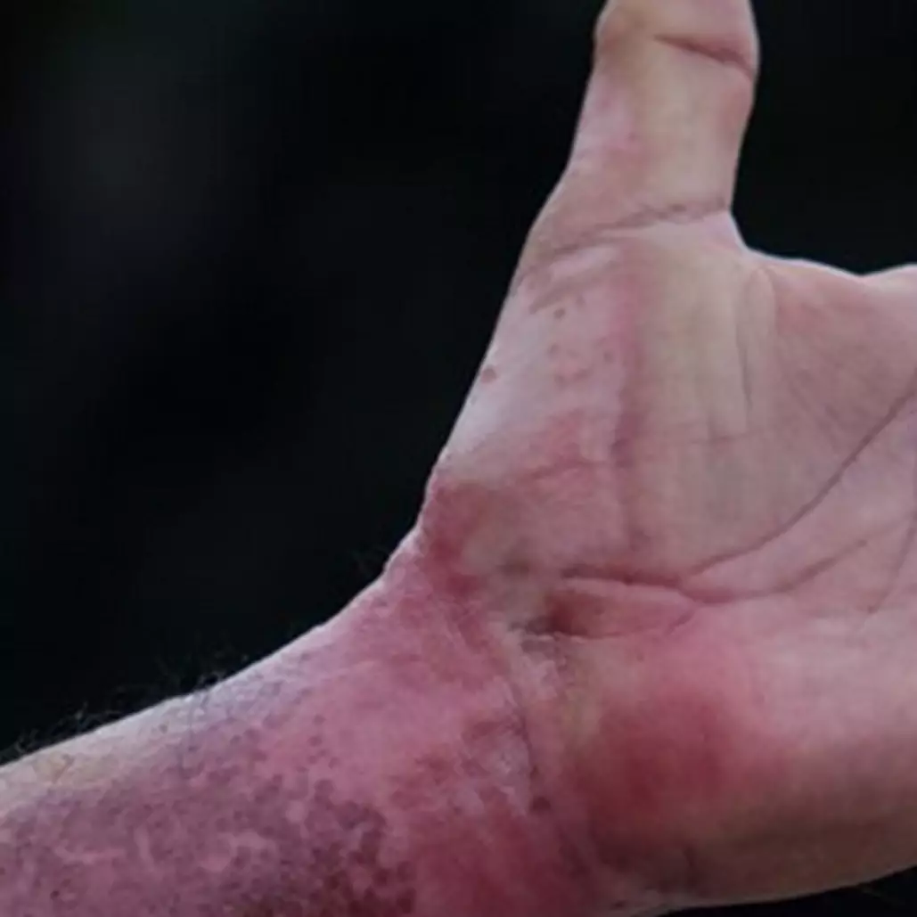 Cara pudarkan flek hitam di tangan dan kaki pakai body scrub dari 1 jenis rempah, bikin putih alami