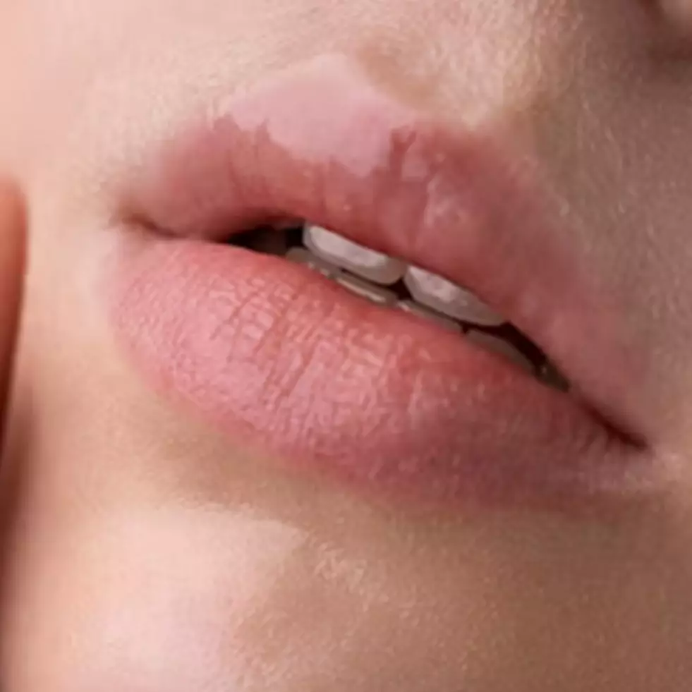 Jadi halus dan tampak kencang, ini trik hilangkan kerutan di area mulut pakai 1 jenis karbohidrat