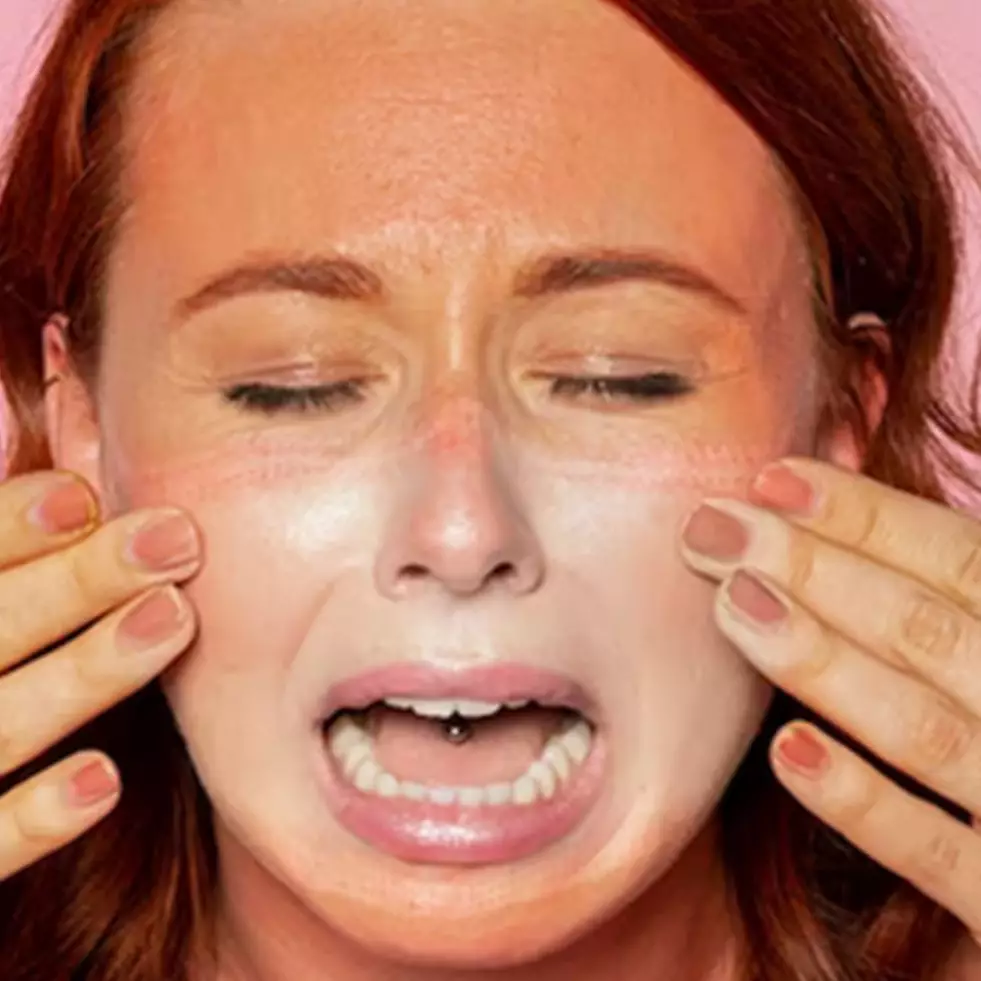 Hanya pakai 1 jenis minuman, ini cara atasi kulit terbakar akibat sinar matahari agar tak iritasi