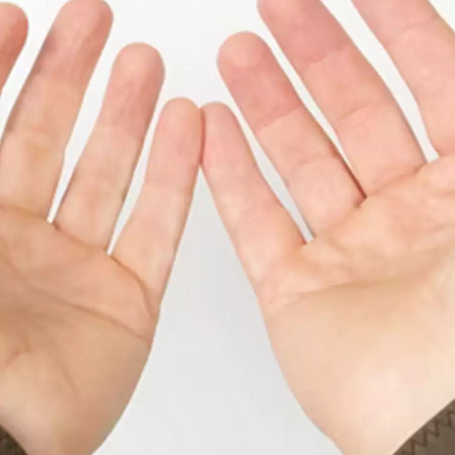 Tanpa garam, ini cara atasi kulit telapak tangan yang mengelupas hanya pakai 1 jenis karbohidrat