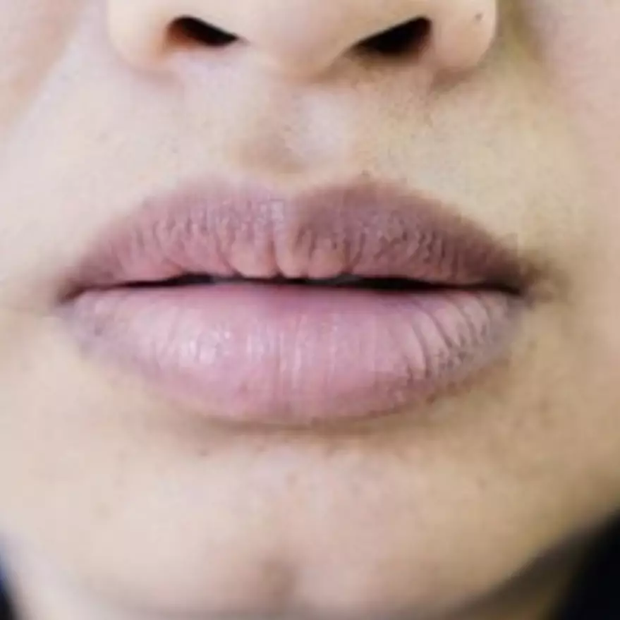 Cerah alami dalam 7 hari, ini trik antiribet pudarkan bibir gelap pakai 1 jenis kulit buah