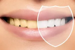 Bukan pakai garam, begini trik memutihkan gigi kuning dan berkerak pakai 1 jenis buah