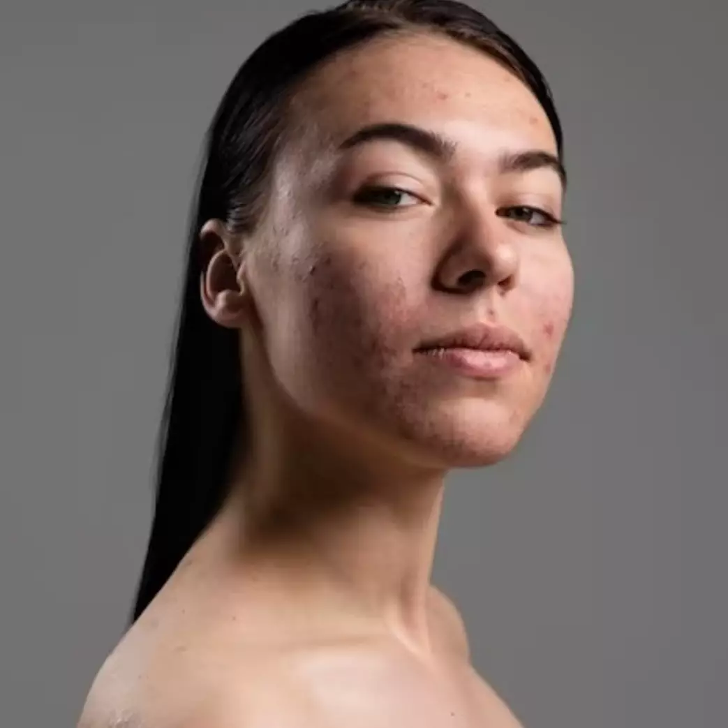 Trik atasi tekstur kulit kasar pakai masker 2in1 dari 1 jenis bahan makanan, auto lembut dan cerah