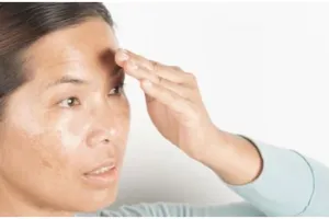 Wajah 10 tahun awet muda modal 5 ribu, ini cara hilangkan spot hitam pakai serum dari 2 jenis buah