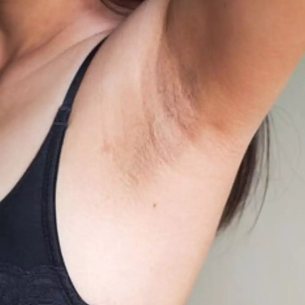 Mulus dan cerah bak model, ini trik memutihkan ketiak gelap pakai 1 bahan minuman