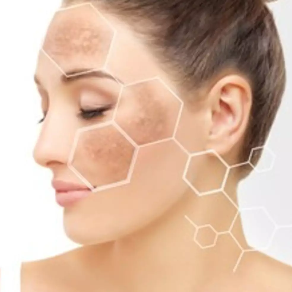 Jadi cerah merona, ini trik atasi noda pigmentasi untuk semua jenis kulit pakai 1 jenis akar tanaman