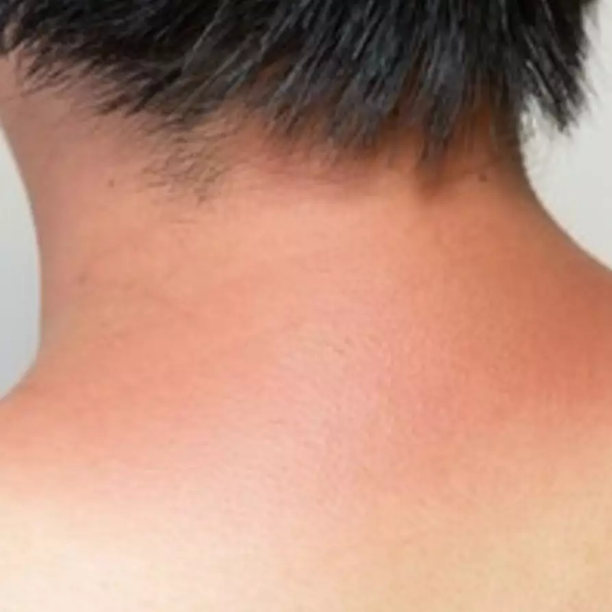 Trik simpel pudarkan kulit badan belang pakai 1 jenis tepung, auto cerah merata