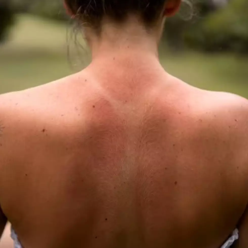 Trik ratakan warna leher bagian belakang pakai 1 jenis bahan pemanis, kulit jadi bebas belang