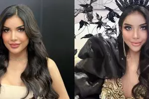 8 Potret terbaru Millen Cyrus usai operasi hidung, disebut mirip Ayu Azhari hingga Priyanka Chopra