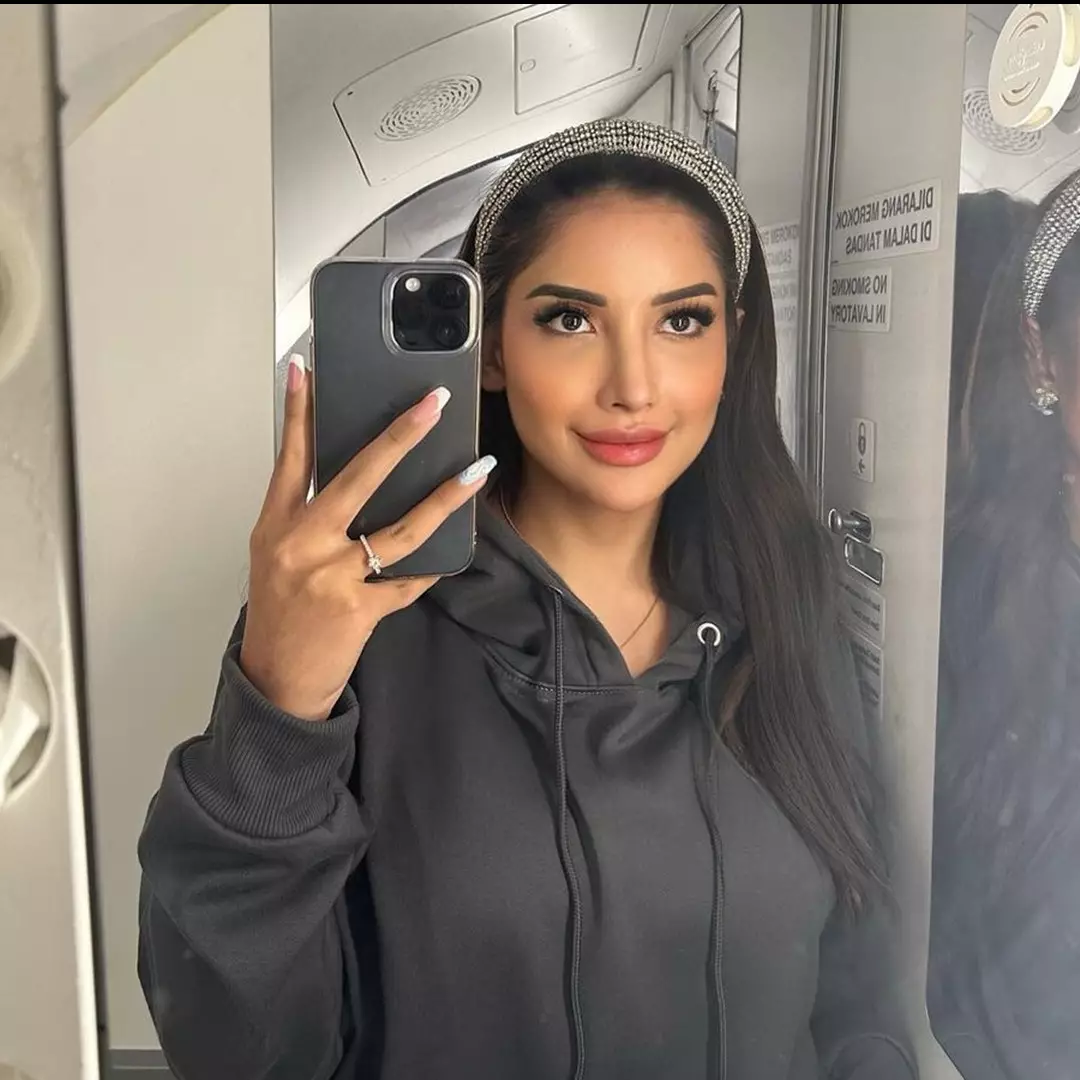 Potret 13 seleb sebelum dan sesudah operasi hidung, penampilan Millen Cyrus disebut bak beda orang