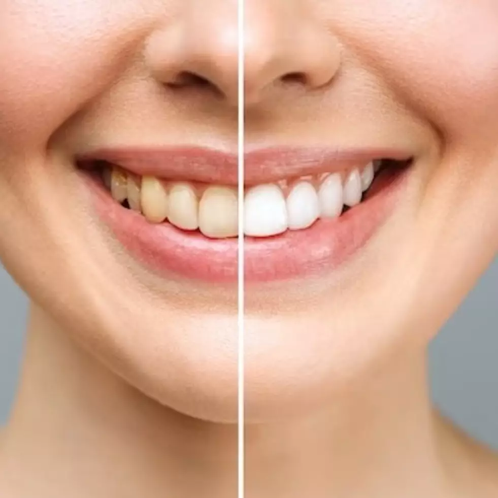 Bukan pakai obat kumur, ini trik usir gigi kuning dan bau mulut sekaligus pakai 1 jenis minyak