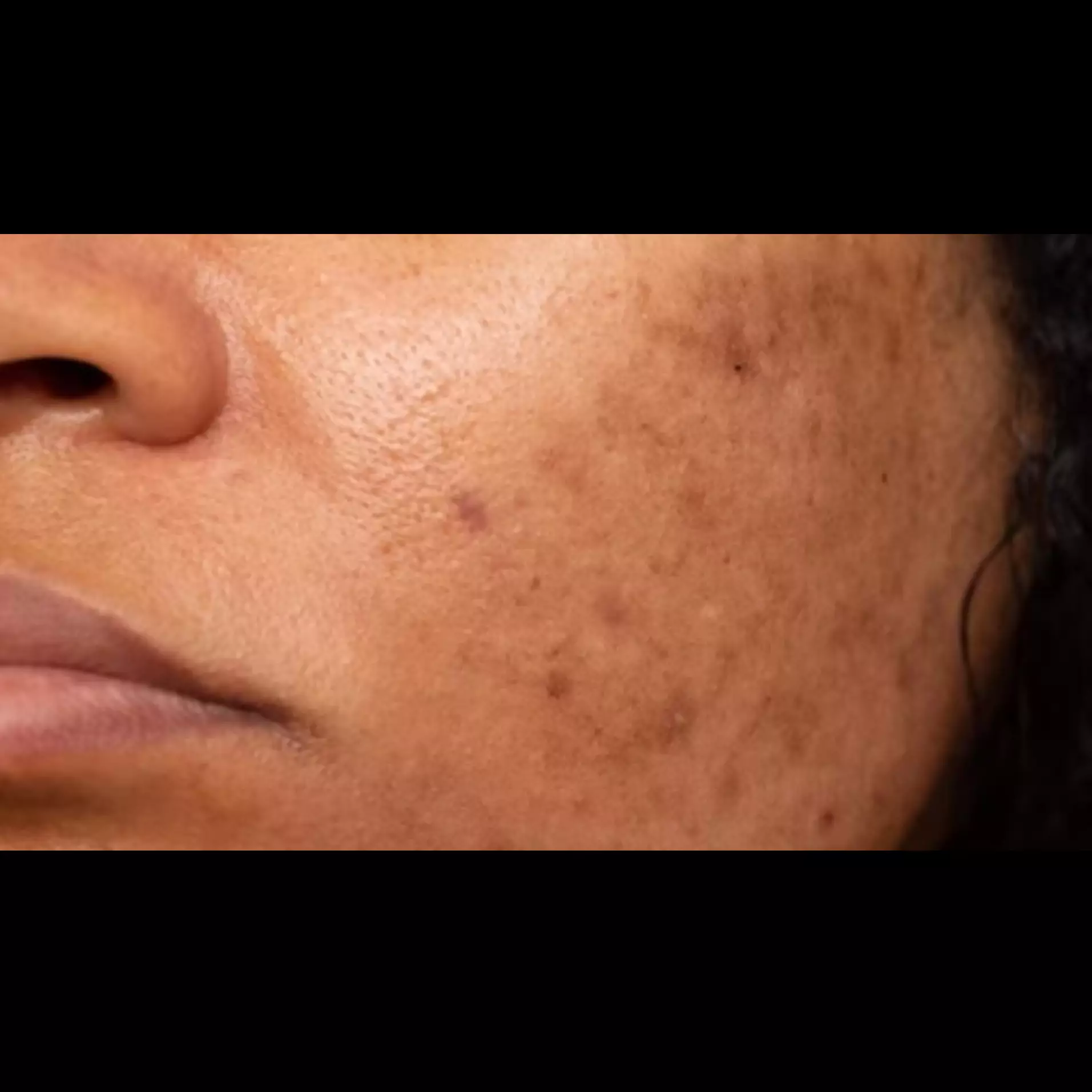 Tak perlu pakai kunyit, ini trik menghilangkan flek hitam membandel hanya pakai 1 jenis bahan pemanis