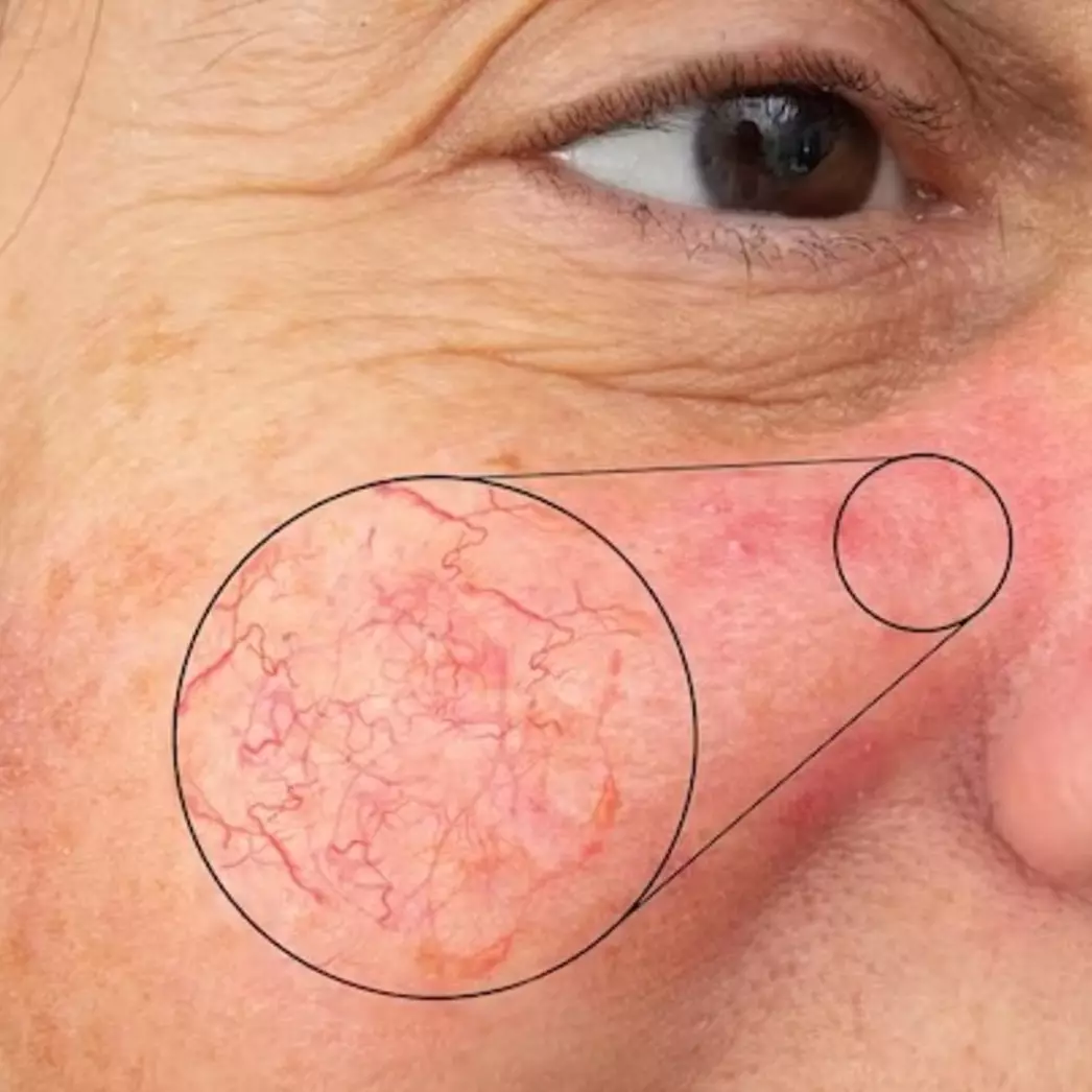 Lembap tanpa aloe vera, ini trik cegah penuaan dini pada kulit kering pakai toner dari 1 jenis sayuran