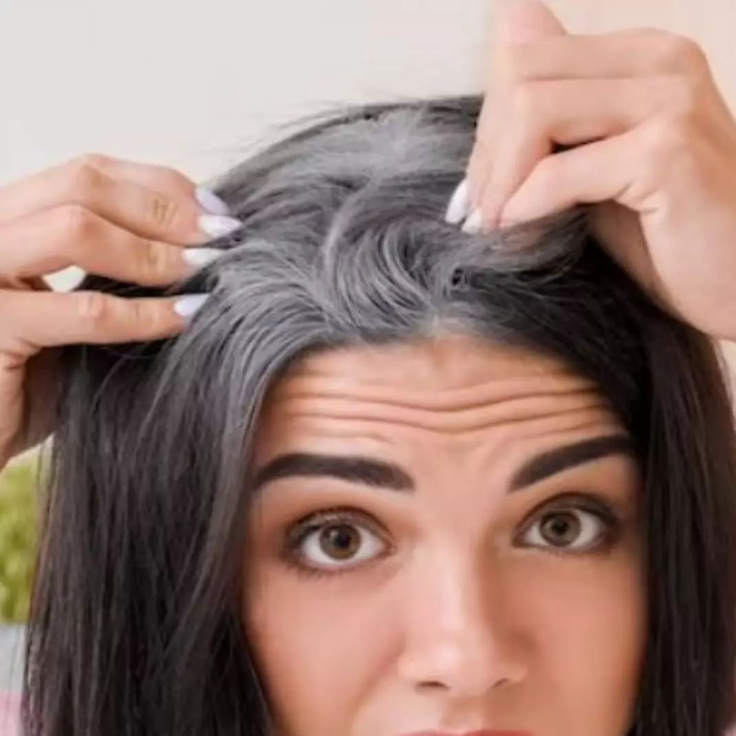 Bukan pakai hair tonic, ini cara atasi uban dan suburkan rambut hitam dengan 1 jenis rempah