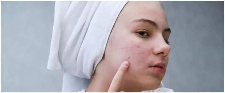 Bukan dengan kunyit, ini cara samarkan garis halus dan flek hitam hanya pakai 1 jenis biji-bijian