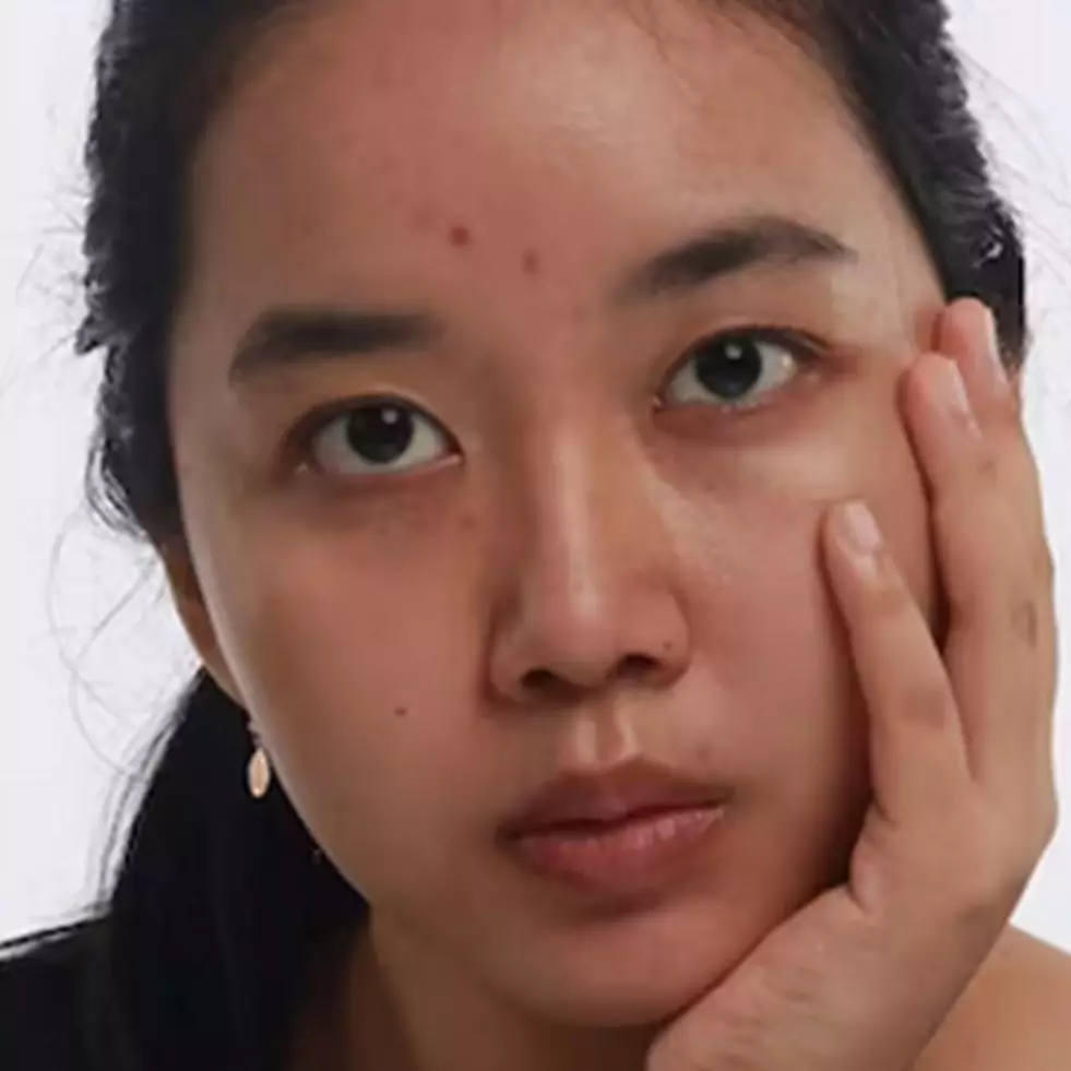 Bukan dengan kopi, ini trik cerahkan flek hitam akibat penggunaan produk skincare pakai 2 bahan alami