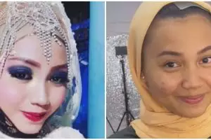Wanita ini dirias jadul saat menikah, 9 potretnya usai di-makeup ulang karena salah MUA bikin nyesek