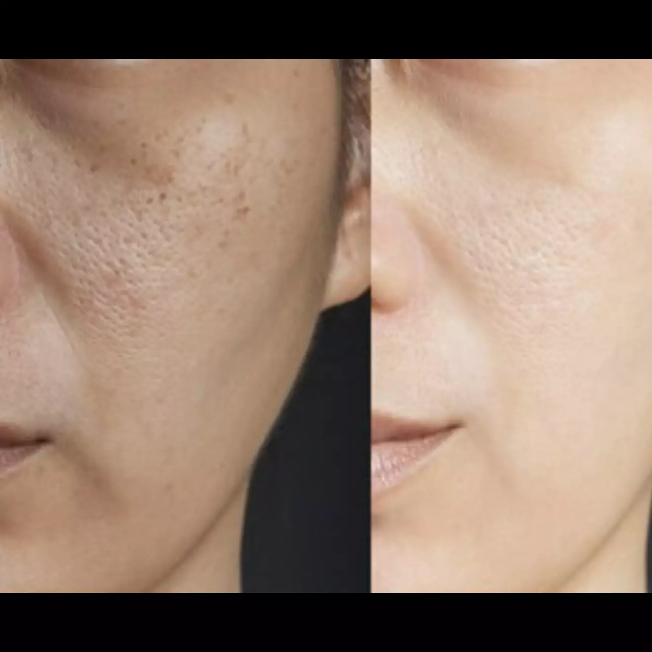 Bukan cuma air beras, ini trik tepis kusam agar kulit tampak segar dan cerah pakai 1 jenis sayuran