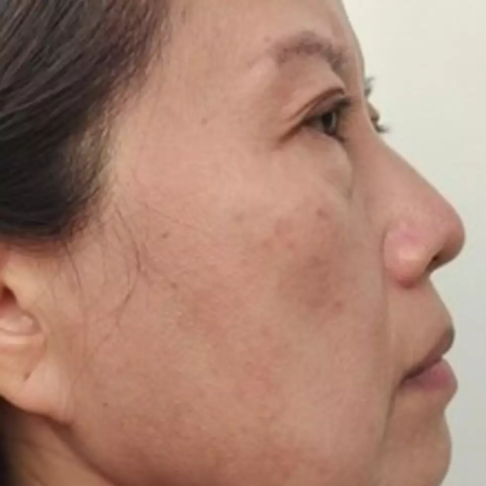 Bukan dengan kunyit, ini trik agar wajah bersinar dan bebas keriput pakai krim dari 1 ampas minuman