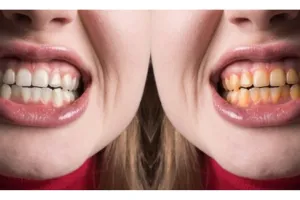 Bukan pakai kulit pisang, ini trik cegah warna gigi kuning dan berlubang pakai 1 jenis rempah