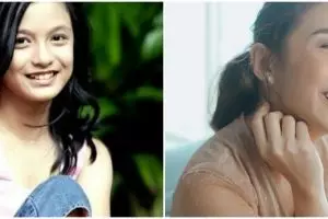 Hilangkan gigi gingsul yang jadi ciri khasnya, intip 11 transformasi Chelsea Olivia