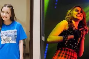 Penampilan baru 6 seleb usai hilangkan gigi gingsul, Chelsea Olivia bikin pangling