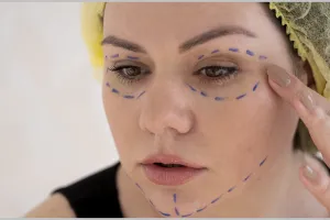 Nggak perlu serum antiaging, ini trik pudarkan garis halus pakai masker botoks dari 1 jenis protein