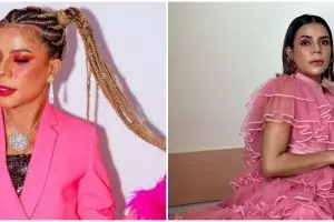 Tak malu pamer bercak-bercak di wajah, 5 potret Nowela Idol kena cacar air saat dewasa