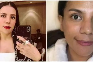 Pede pamer wajah penuh luka bekas cacar air, ini 9 potret Nowela Idol saat pakai vs tanpa makeup