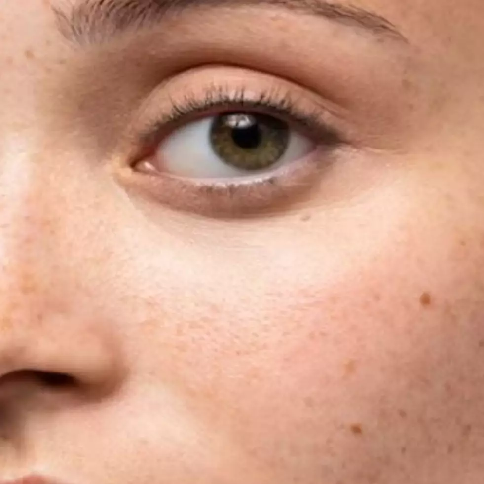 Bukan pakai lemon dan kunyit, begini trik atasi flek hitam penyebab wajah kusam dengan 1 jenis buah