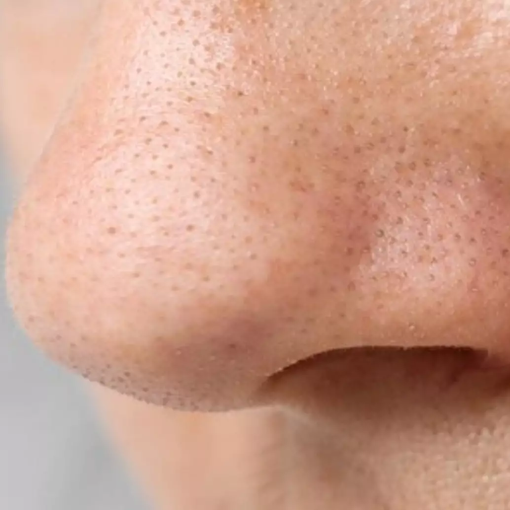 Tanpa baking soda dan kopi, ini trik mengecilkan pori-pori wajah pakai 1 jenis bahan makanan